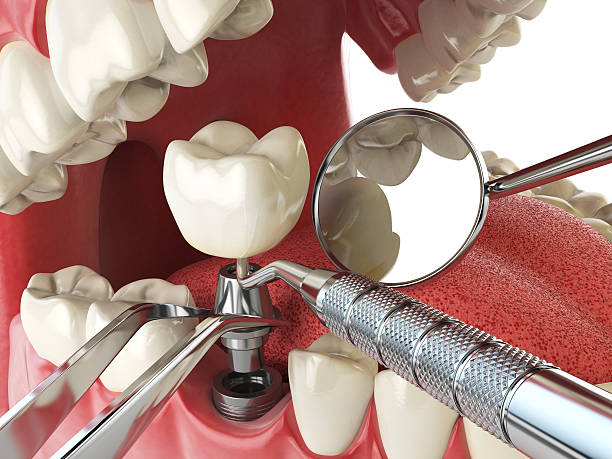 Best Pediatric Emergency Dentist in Rockton, IL